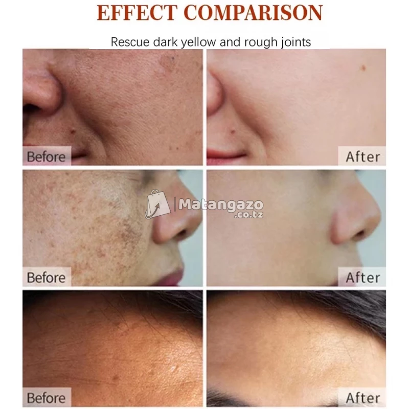 darkspot corrector