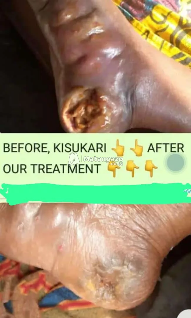 NEW STEAM CELL THERAPY TECHNOLOGY